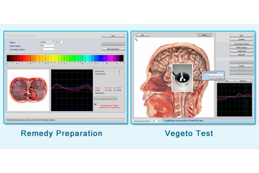 Computer non linear diagnostics